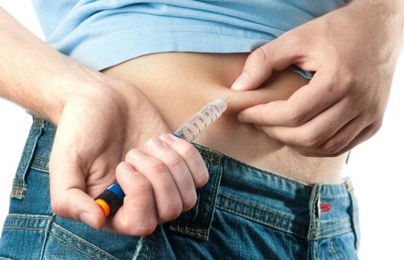 严重2型糖尿病需要注射胰岛素